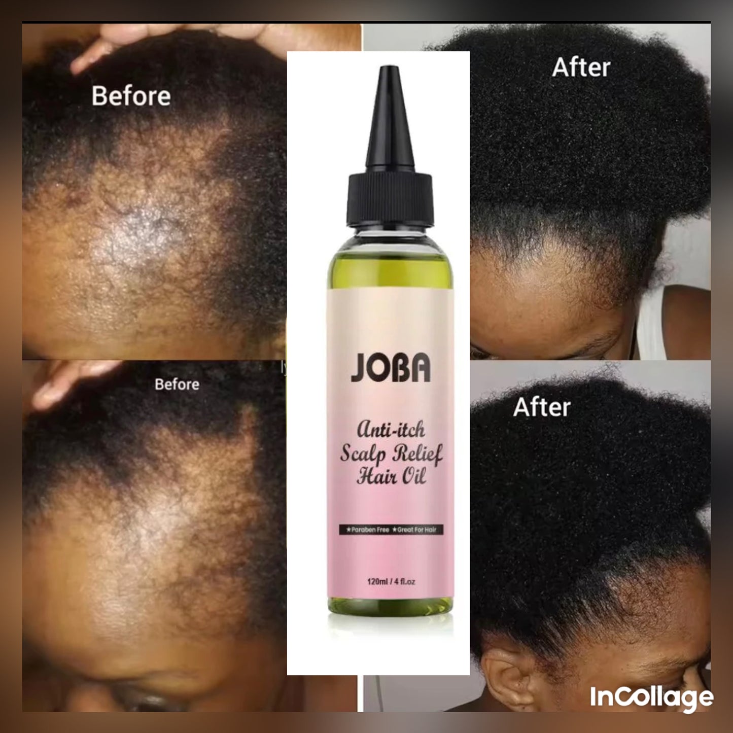 Hair growth JOBA SET 2